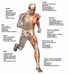 Gigalaser - Kann brúkast til øll sløg av pínu