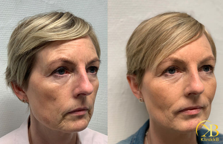 Ann-Mari-h-sida-FILLER