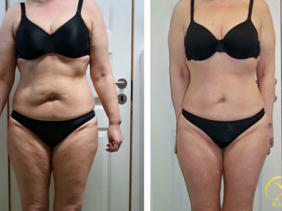 Annbritt-Gerster-FEITTFRYST-LPG