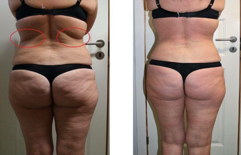 Annbritt aftan før efter