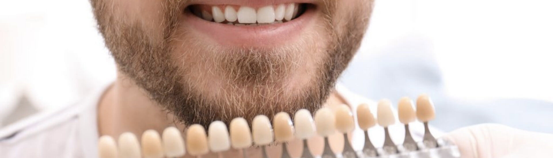 tannbleiking topp madur