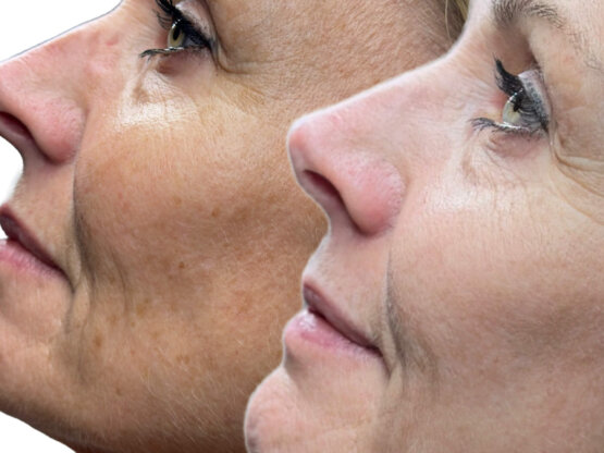 593D17E6-88BC-4FA3-AE25-0EB8A1C7F09D