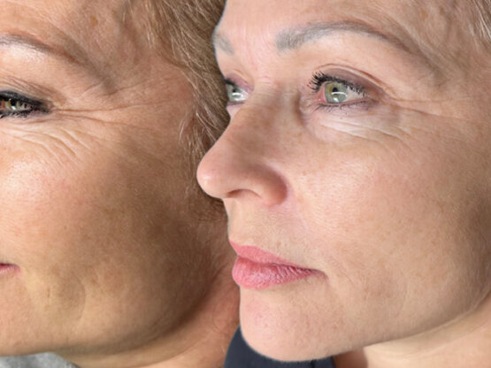 Før efter 775 x 500. Eliza 1 light and bright