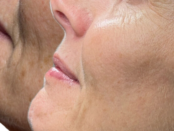 Før efter 775 x 500. Unn 2 light and bright