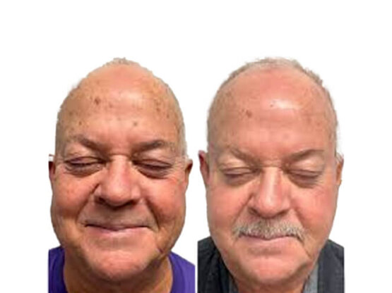 Ikke-navngivet-11 1 x frax 1940 madur