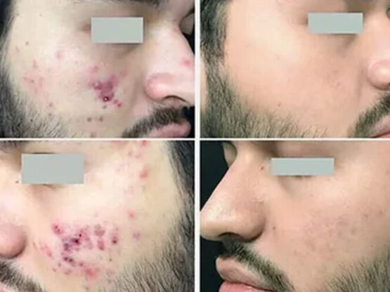 Ikke-navngivet-11. 6 frax 1550 og pr