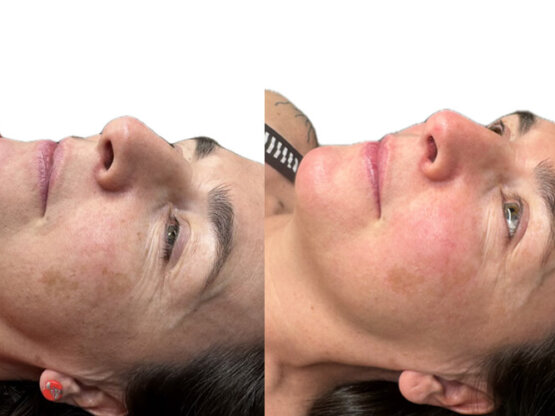 Ikke-navngivet-11. Helen á Lakjuni 1 IPL