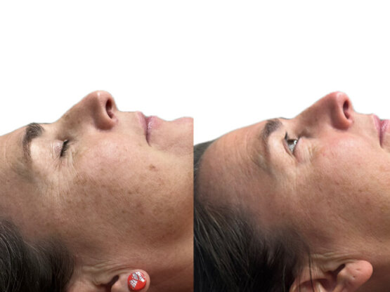 Ikke-navngivet-11. Katrin á Lakjuni 1 IPL h