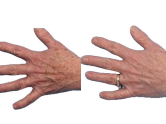 Ikke-navngivet-11.hendur 3 fra 1940