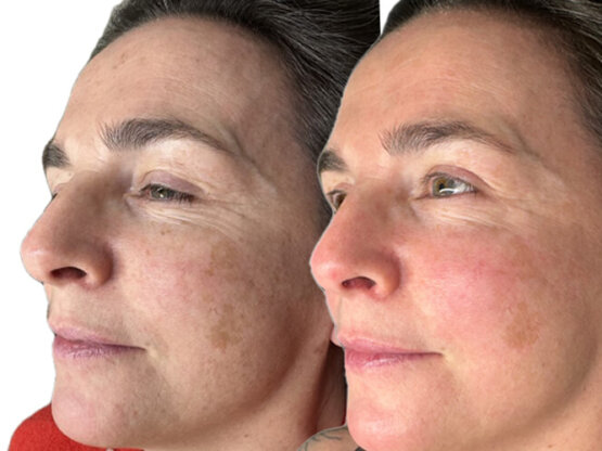 Ikke-navngivet-11.jpg IPL