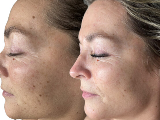 Ikke-navngivet-11.jpg IPL AM1