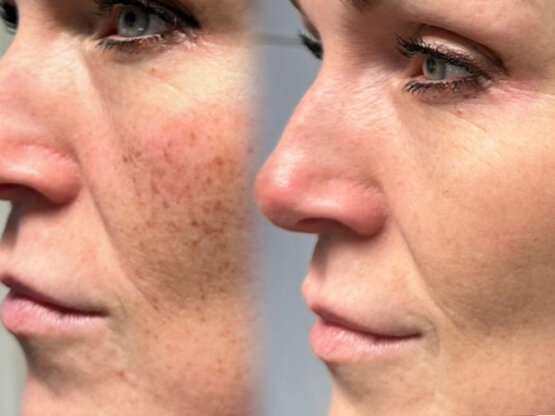 Ikke-navngivet-11.jpg IPL HER