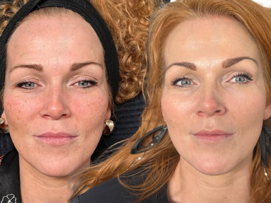 Ikke-navngivet-11.jpg IPL He