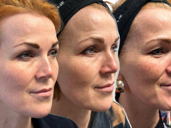 Ikke-navngivet-11.jpg IPL Herborg 2