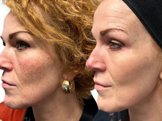 Ikke-navngivet-11.jpg IPL Herborg