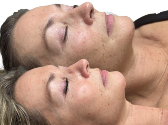 Ikke-navngivet-11.jpg IPL am