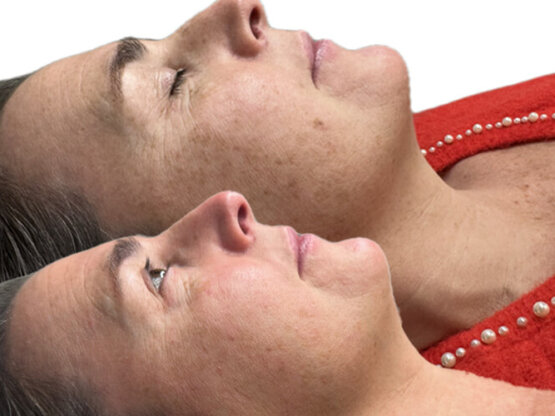 Ikke-navngivet-11.jpg IPL gg