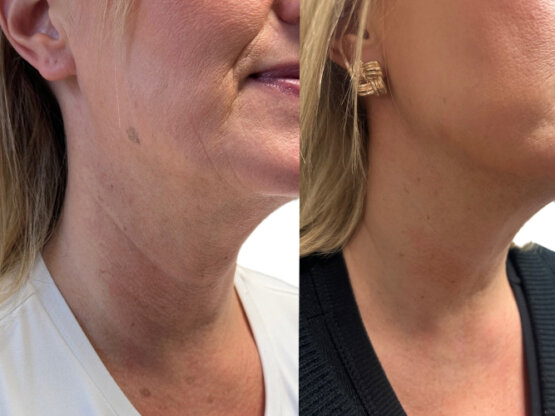 Ikke-navngivet-11.jpg Moderm