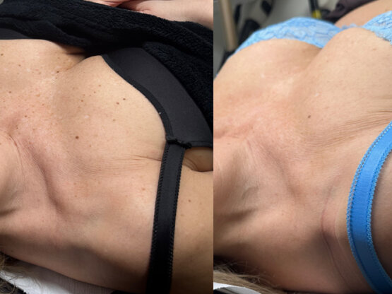 Ikke-navngivet-11.jpg de222