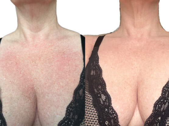 Ikke-navngivet-11.jpg dekolle 1