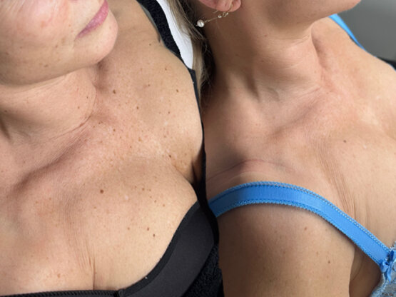 Ikke-navngivet-11.jpg dekollll