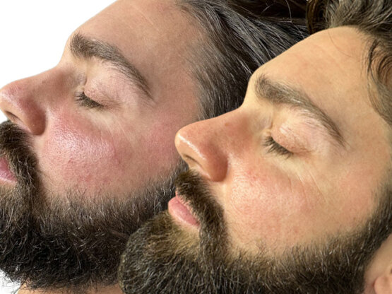 Ikke-navngivet-11.jpg lu ipl