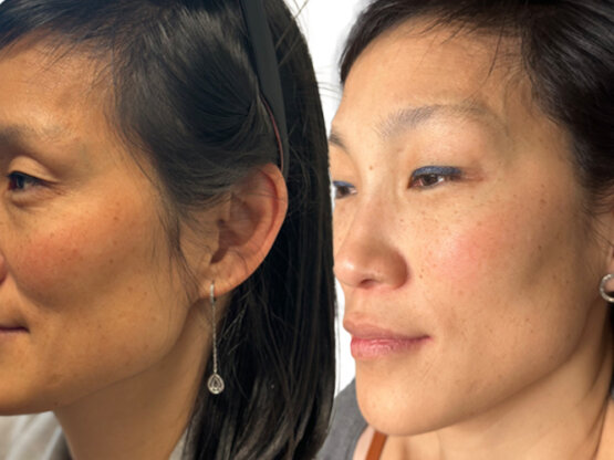 Ikke-navngivet-11.jpg mol