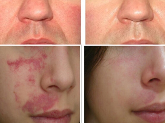 Ikke-navngivet-11.jpg ro 3