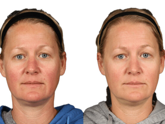 Ikke-navngivet-11.jpg ro1