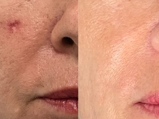 Ikke-navngivet-12. 2 x light and bright arr