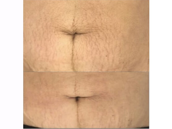 Ikke-navngivet-12.1 x frax 1550