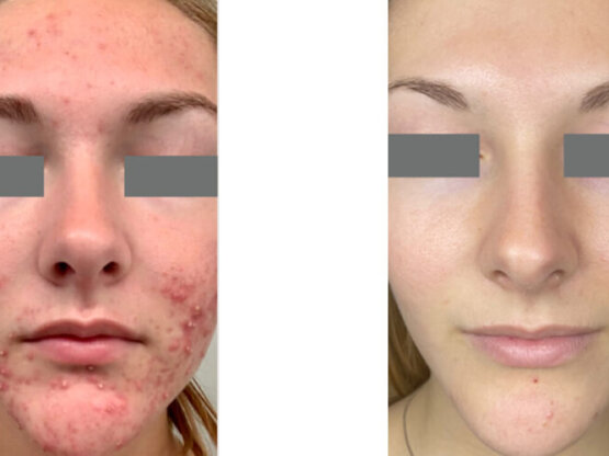 Ikke-navngivet-13. 8 x liht and bright