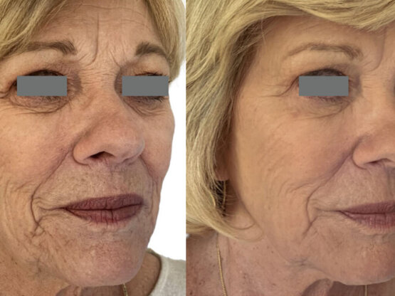 Ikke-navngivet-14. 1 x light and bright