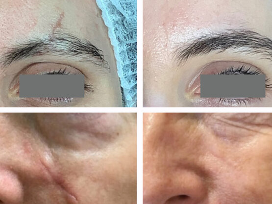 Ikke-navngivet-14. light and bright x 2-3 arr