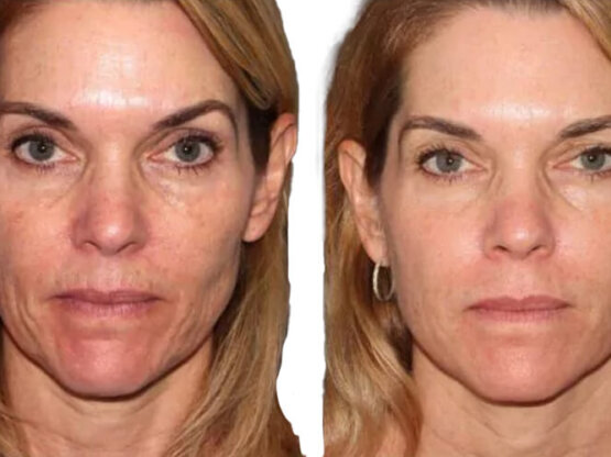 Ikke-navngivet-8.jpglDua Dul Frax