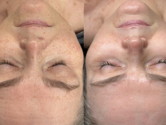 Før efter 775 x 500.jpg Irdi 2