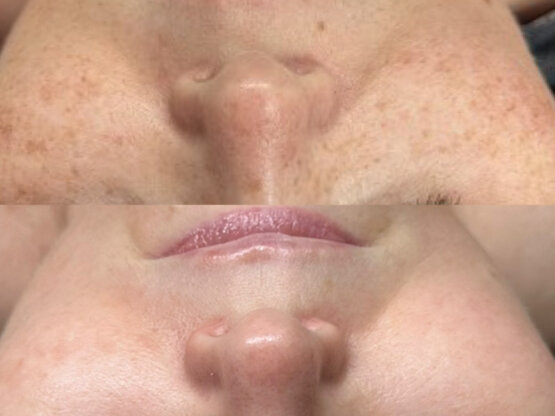 Før efter 775 x 500.jpg Irdi 4