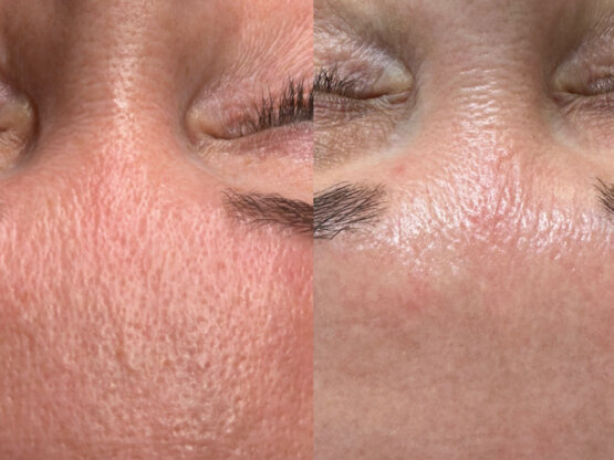 Før efter 775 x 500.jpgpanna 2