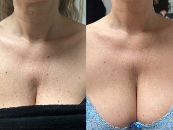 Ikke-navngivet-10.jpg Anna Marita dek 1