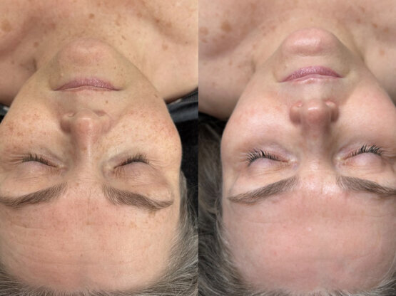 Ikke-navngivet-10.jpg Irdi høvd