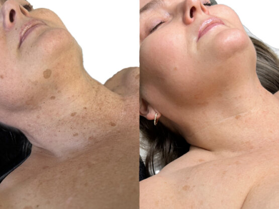 Ikke-navngivet-10.jpg Irdi uppdeilt