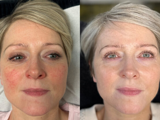 Ikke-navngivet-10.jpg Maika 1