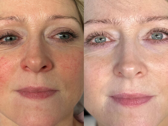 Ikke-navngivet-10.jpg Maika io