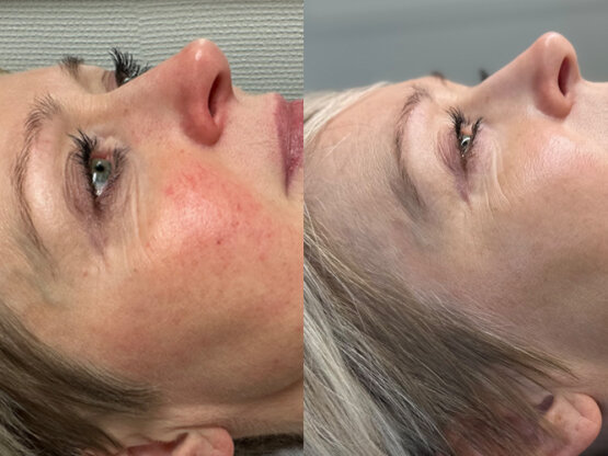 Ikke-navngivet-10.jpg maika 9