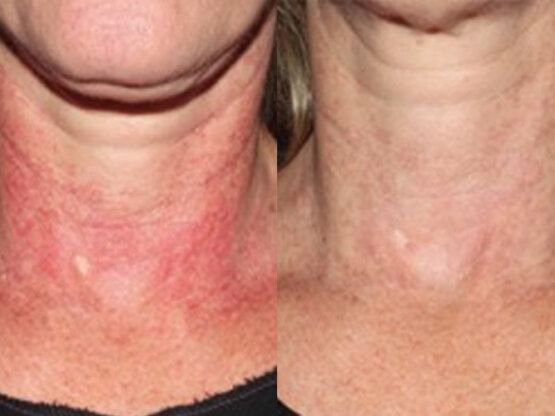 Ikke-navngivet-10.jpg poik