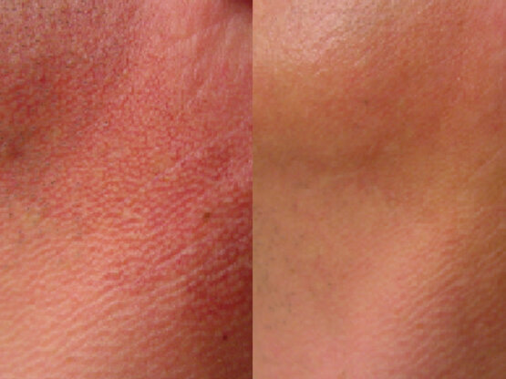 Ikke-navngivet-10.jpg poik1