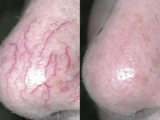 Ikke-navngivet-10.jpg yag 3