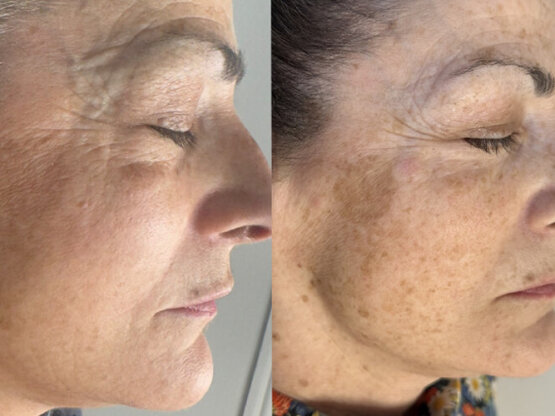 Ikke-navngivet-11.jpg hjhj