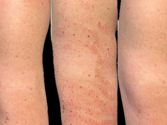 Ikke-navngivet-11.jpg 2 ipl na ar