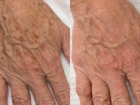 Ikke-navngivet-11.jpg IPL hond